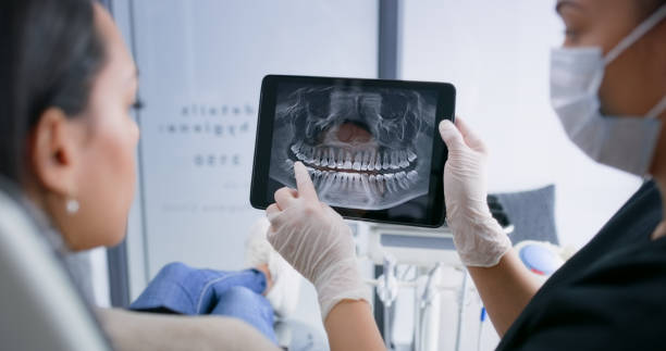 Licensed Tooth Extraction service in Fairfax, SC - Smile Center Dentistry